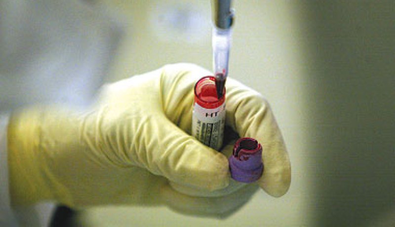 أستراليا تقدم فحصا جديدا لقياس خصوبة المرأة