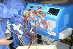 مصابون بالعجز الكلوي‮ ‬يتزوجون من حاملات لنفس الزمرة الدموية لسلب كليتهن