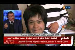 بالإرادة والعزيمة..تريزوميون لم يمنعهم المرض من تحقيق أحلامهم !!