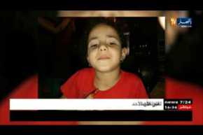 سيدي بلعباس : كلب يهاجم طفلة تبلغ من العمر 6 سنوات !!