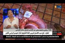 حالات الإصابة بالكيس المائي.. أرقام تدق ناقوس الخطر