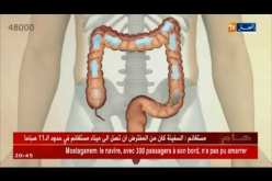 صحة:نقص المناعة بالجهاز الهضمي..سرطان القولون يهدد الجزائريين