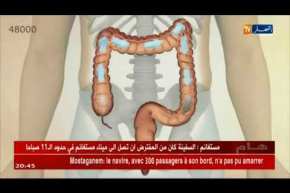 صحة:نقص المناعة بالجهاز الهضمي..سرطان القولون يهدد الجزائريين