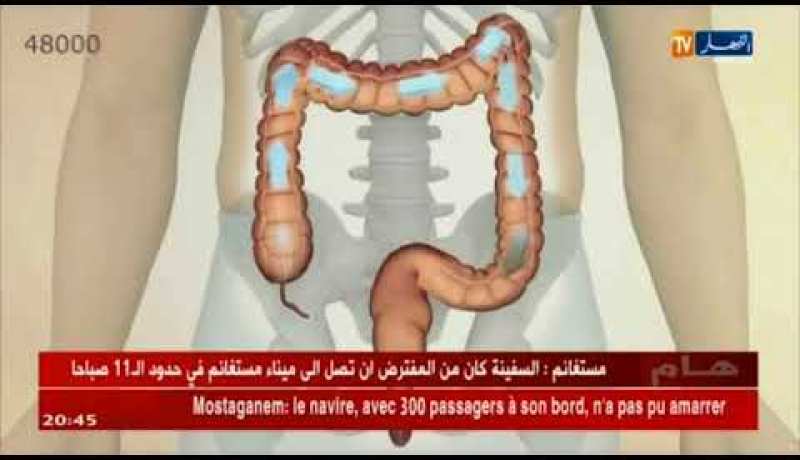 صحة:نقص المناعة بالجهاز الهضمي..سرطان القولون يهدد الجزائريين