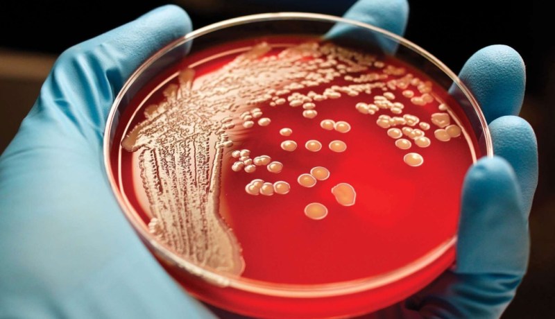 إبتكار لقاح للعلاج والوقاية من أخطر أنواع السرطان