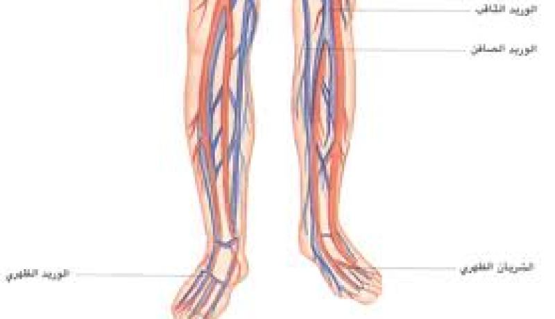 خلل جيني يتسبب في الاصابة بتصلب الشرايين