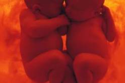 أميركية حامل بطفلين … ليسا توأم