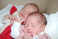 عمليتان منفصلتان لتوأم لاستئصال الزائدة