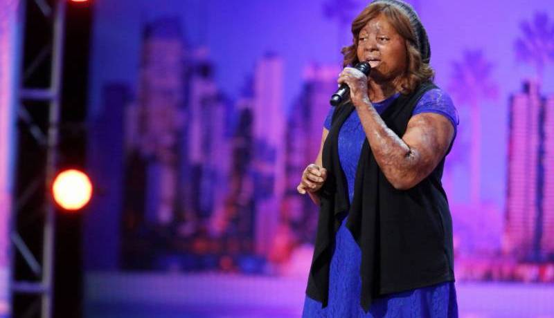 بالفيديو..تحدت الحروق وحصلت على الزر الذهبي في “America’s Got Talent”