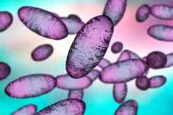 منظمة الصحة العالمية تتحدث عن درجة خطورة الطاعون الدملي