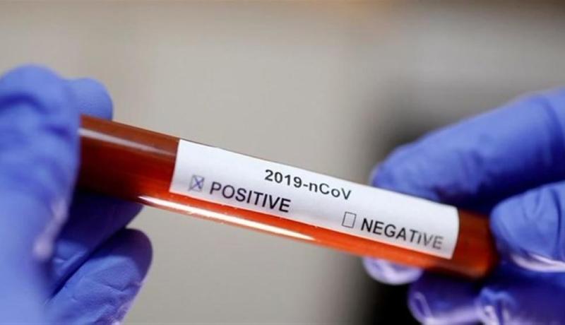 دراسة: هذه فصيلة الدم الأكثر مقاومة لكورونا