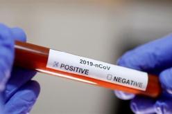 إصابات كورونا عبر العالم تتجاوز الـ 7 ملايين حالة