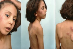 معلّم‮ ‬يعذّب تلميذة عمرها ‮8 ‬سنوات بوحشية في‮ ‬تبسة