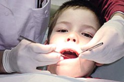 تسوس الأسنان من بين أمراض الفم الأكثر انتشارا بالمجتمع الجزائري