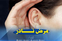 إمرأة لا تسمع أصوات الرجال بسبب مرض نادر !