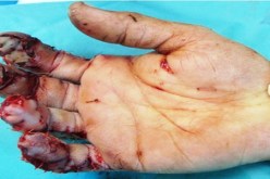 لصوص‮ ‬يبترون أصابع شاب ويطعنون شقيقه وسط مدينة وهران