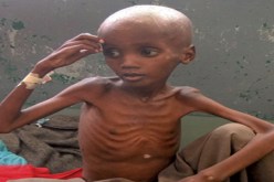 مليون طفل مهدد بالموت بسبب المجاعة في منطقة الساحل