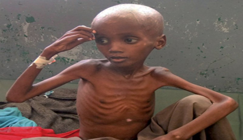 مليون طفل مهدد بالموت بسبب المجاعة في منطقة الساحل