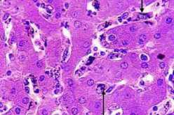 مغتربون وأجانب‮ ‬يدخلون طفيليات الملاريا والسل إلى الجزائر