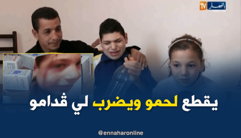 المرض يدفع  طفل لتقطيع لحمه وضرب والديه ببجاية