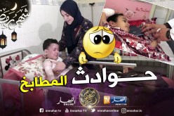 41 حالة إصابة بالحروق خلال الأسبوع الأوّل من رمضان