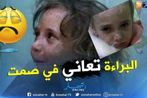 الطارف: شمس الدين طفل القمر..ملامح براءة غيرها المرض والعوز