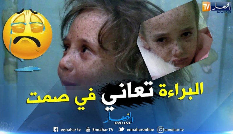 الطارف: شمس الدين طفل القمر..ملامح براءة غيرها المرض والعوز