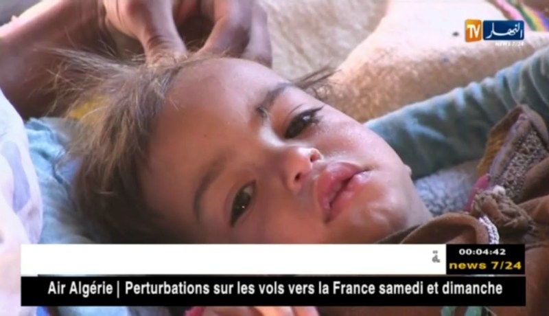 صحة: هل فشلت الوزارة في التصدي لإنتشار داء البوحمرون