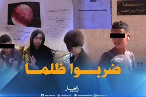 شاهد..مُعلم يتسبّب في إعاقة تلميذ بوهران !!