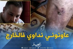 تيزي وزو/ ورم في الرجل يحول حياة “ياسين” إلى جحيم