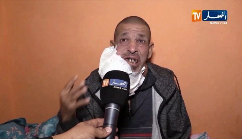 سيدي بلعباس/ ورم كبير يهدد حياة طيب حمدان