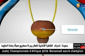 صحة : المثانة العصبية ..5 آلاف حالة سنويا و 170 مليون سنتيم تكلفة المريض الواحد