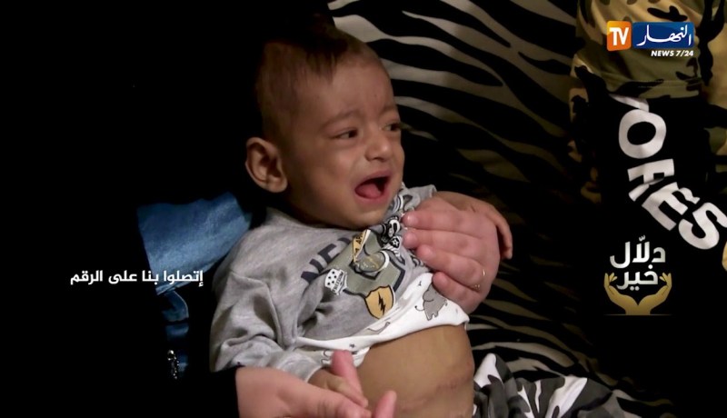 دلال خير: رضيع بحاجة ماسة لإجراء عملية جراحية دقيقة بتركيا وظروف عائلته المادية لا تسمح بذلك