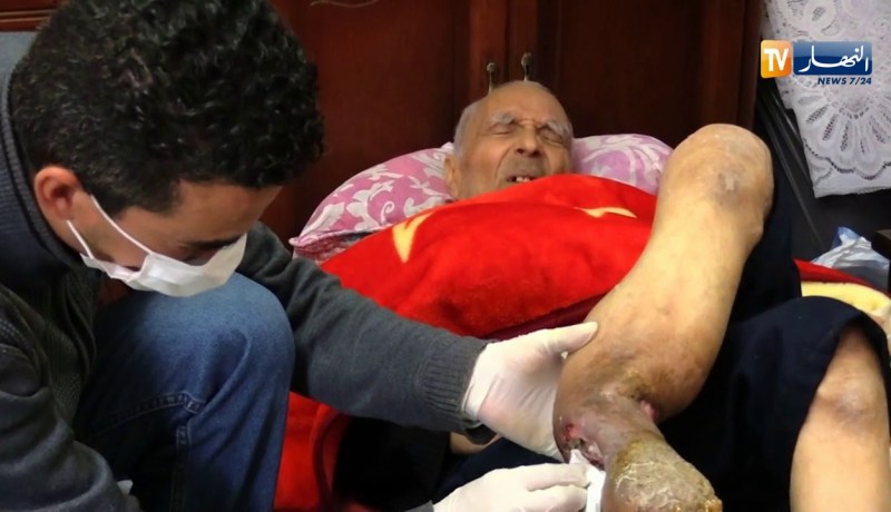 مجتمع/ محمد برجل متعفن..والمستشفيات ترفض إستقباله