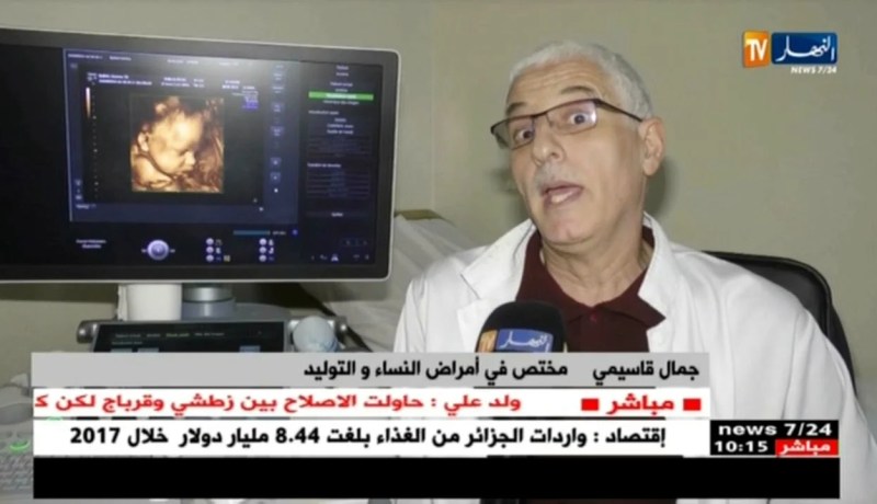 صحة/ تراجع الخصوبة لدى أزواج اليوم…ما هي الأسباب ؟