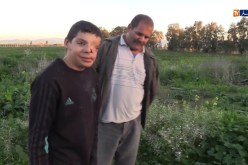 الطارف.. التشوه الخلقي يحول حياة الطفل صبري الى جحيم