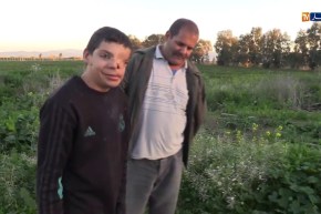 الطارف.. التشوه الخلقي يحول حياة الطفل صبري الى جحيم