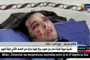 عنابة: ممرضو مصلحة الإستعجالات بمستشفى ابن رشد في إضراب عن العمل