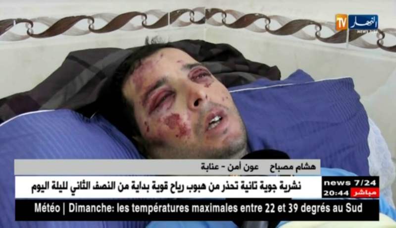 عنابة: ممرضو مصلحة الإستعجالات بمستشفى ابن رشد في إضراب عن العمل