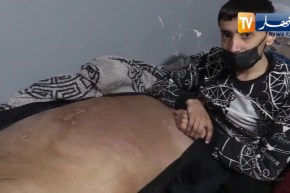 المدية : الجالية الجزائرية في الخارج تتحرك بعد بث حالة أمين بوهالي