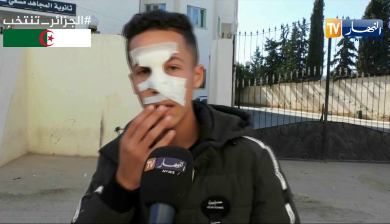 تبسة: تلميذ ينزف يجبر على الدخول إلى الإمتحانات دون تقديم له الإسعافات