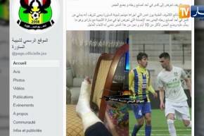 يحيى شريف يصاب بكسر في أصبع قدمه ويضع الجبس لـ 10 أيام