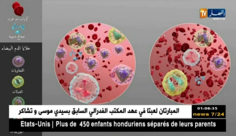 صحة: سرطان الدم الليمفاوي .. يفتك بالجزائريين في صمت