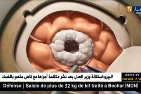 صحة: 200 إصابة بسرطان المخ عند الأطفال سنويا بالجزائر