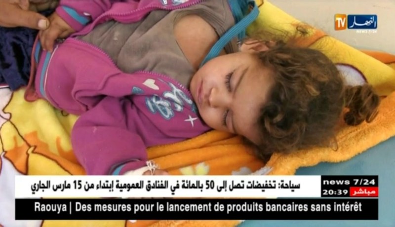 صحة: الكساح والتيفويد يهدد الجزائريين نتيجة العزوف عن التلقيح