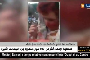 بومرداس: إبن يعتدي بالسكين على والدته ببرج منايل