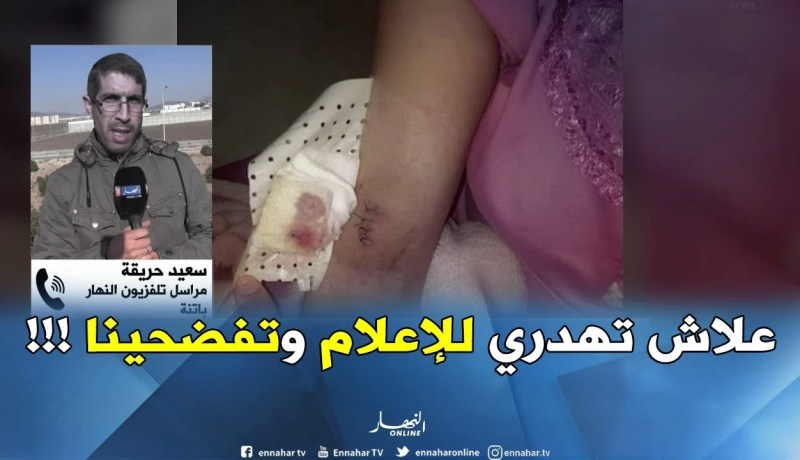 “علاش تروحي للإعلام وتهدري ؟!! “.. هكذا تهجّم طبيب على المرأة الحامل بباتنة !!!