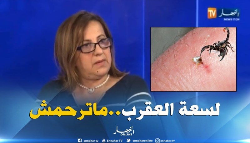 الدكتورة عليان فريدة: هذه هي الحالات التي تؤدي للوفاة بسبب لدغة العقرب