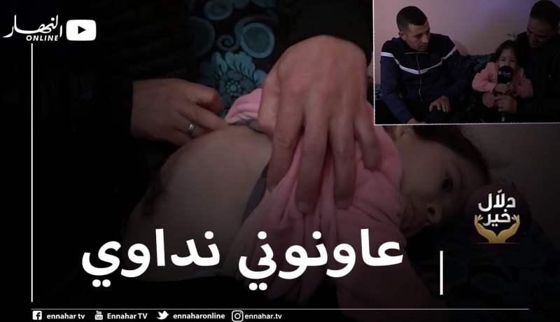 دلال خير: طفلة مصابة بمرض سبينا بيفيدا منذ الولادة.. والداها لم يجدا حلا لمعاناتها