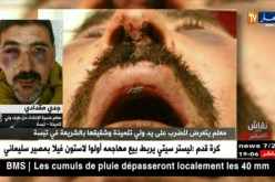 معلم ضحية إعتداء..هكذا إعتدى علي ولي تلميذة وإبنه بوحشية